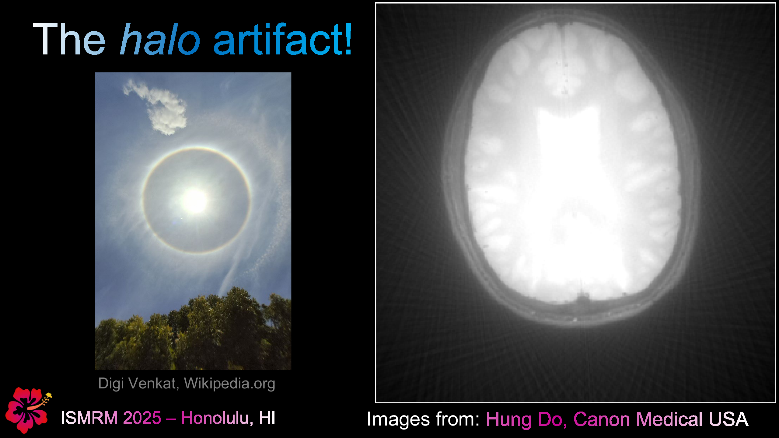 Halo Artifact in Radial MRI