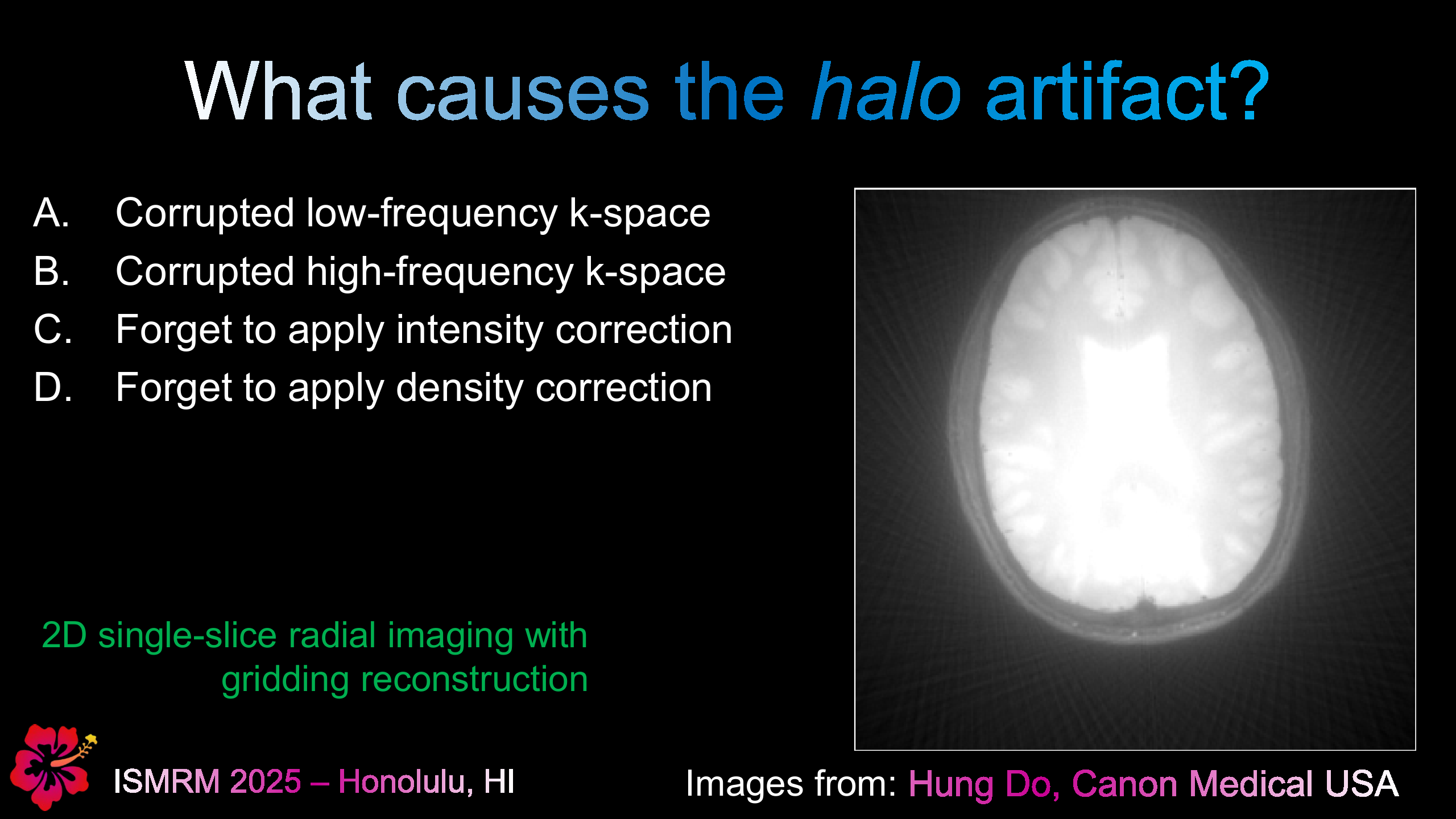 Halo Artifact in Radial MRI - Question
