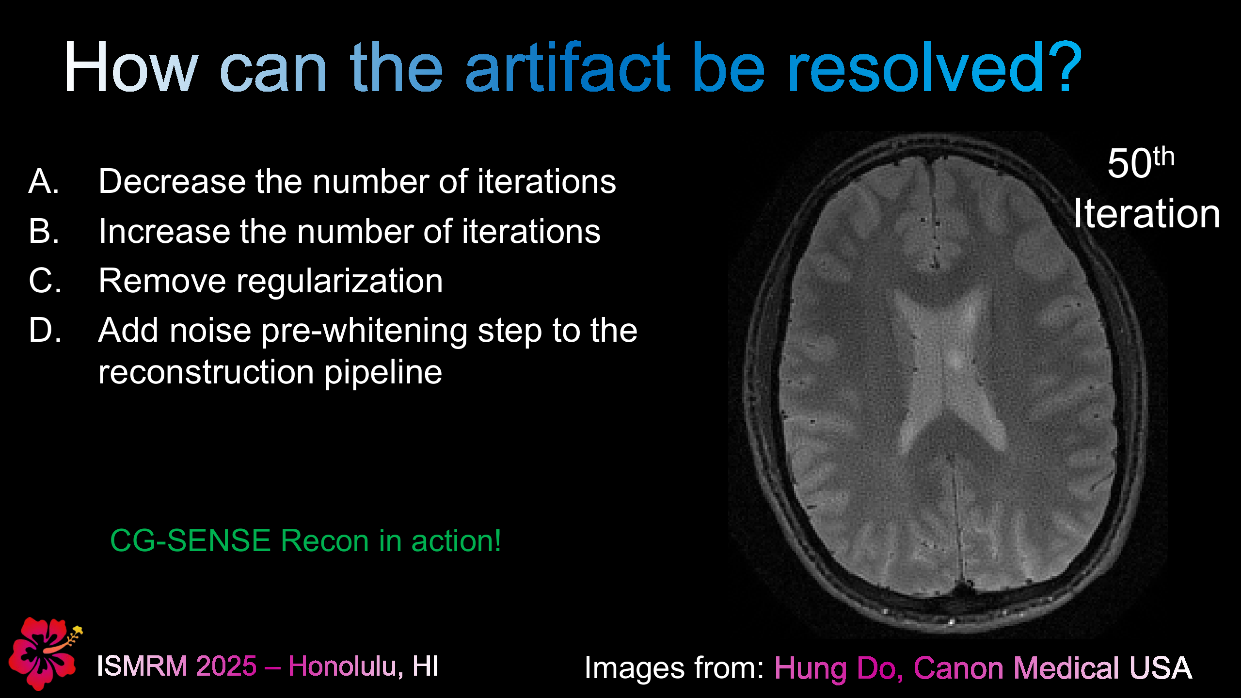 Mysterious Artifact in Radial MRI - Question