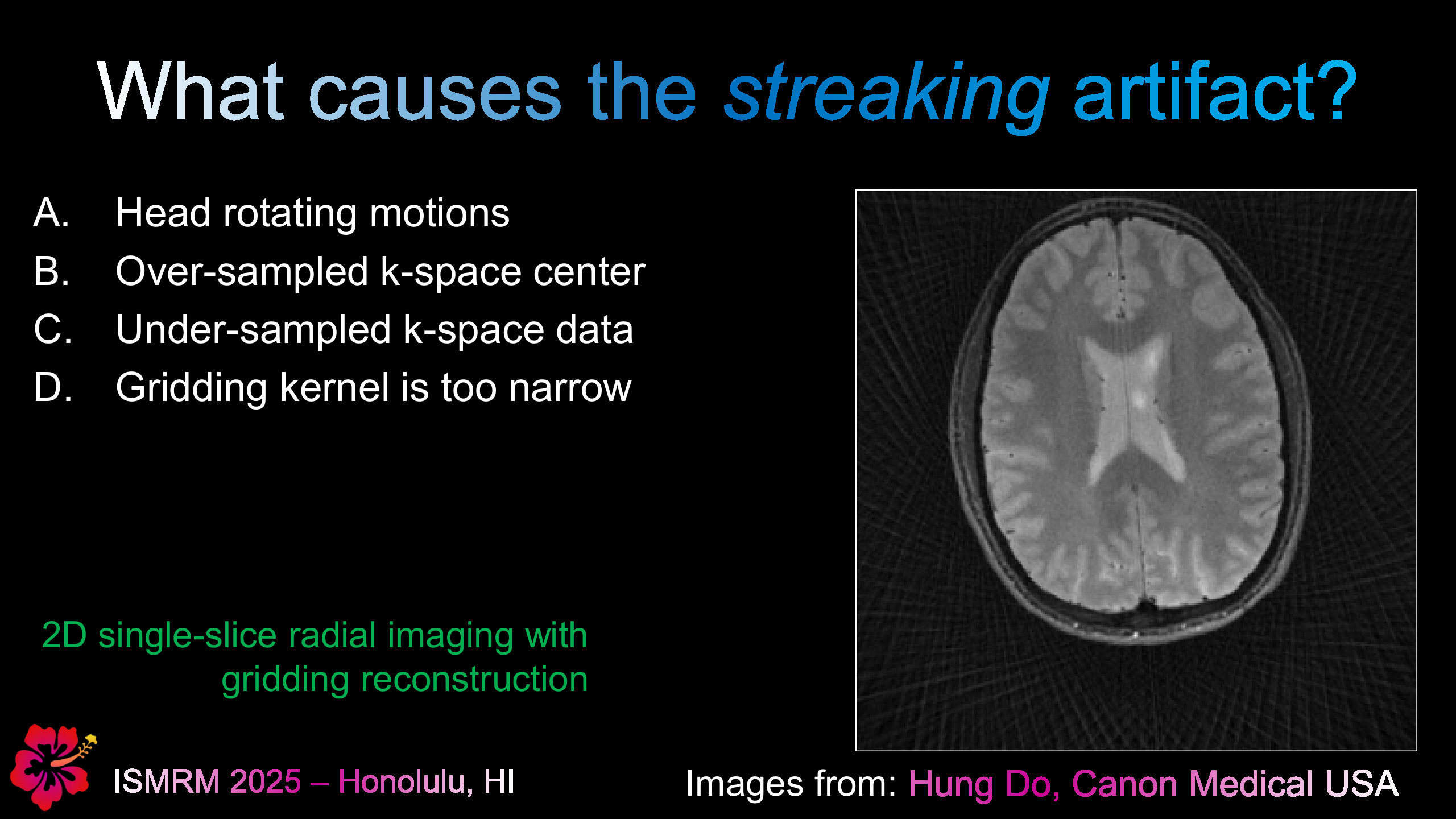 Streaking Artifact in Radial MRI - Question