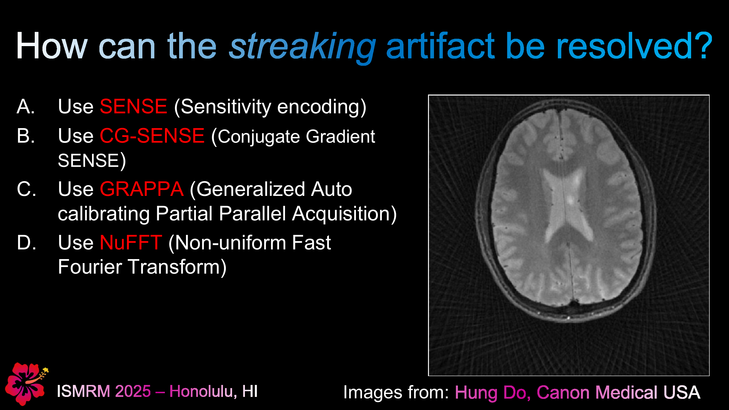 Streaking Artifact in Radial MRI - Question 2
