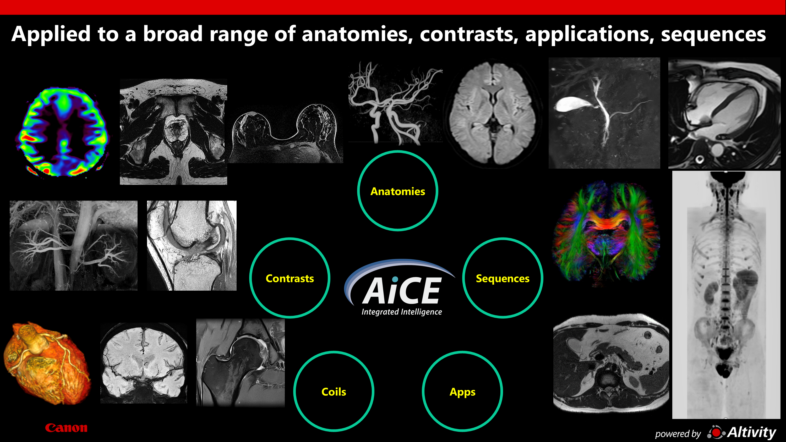 MRI Compressed Sensing Reconstruction