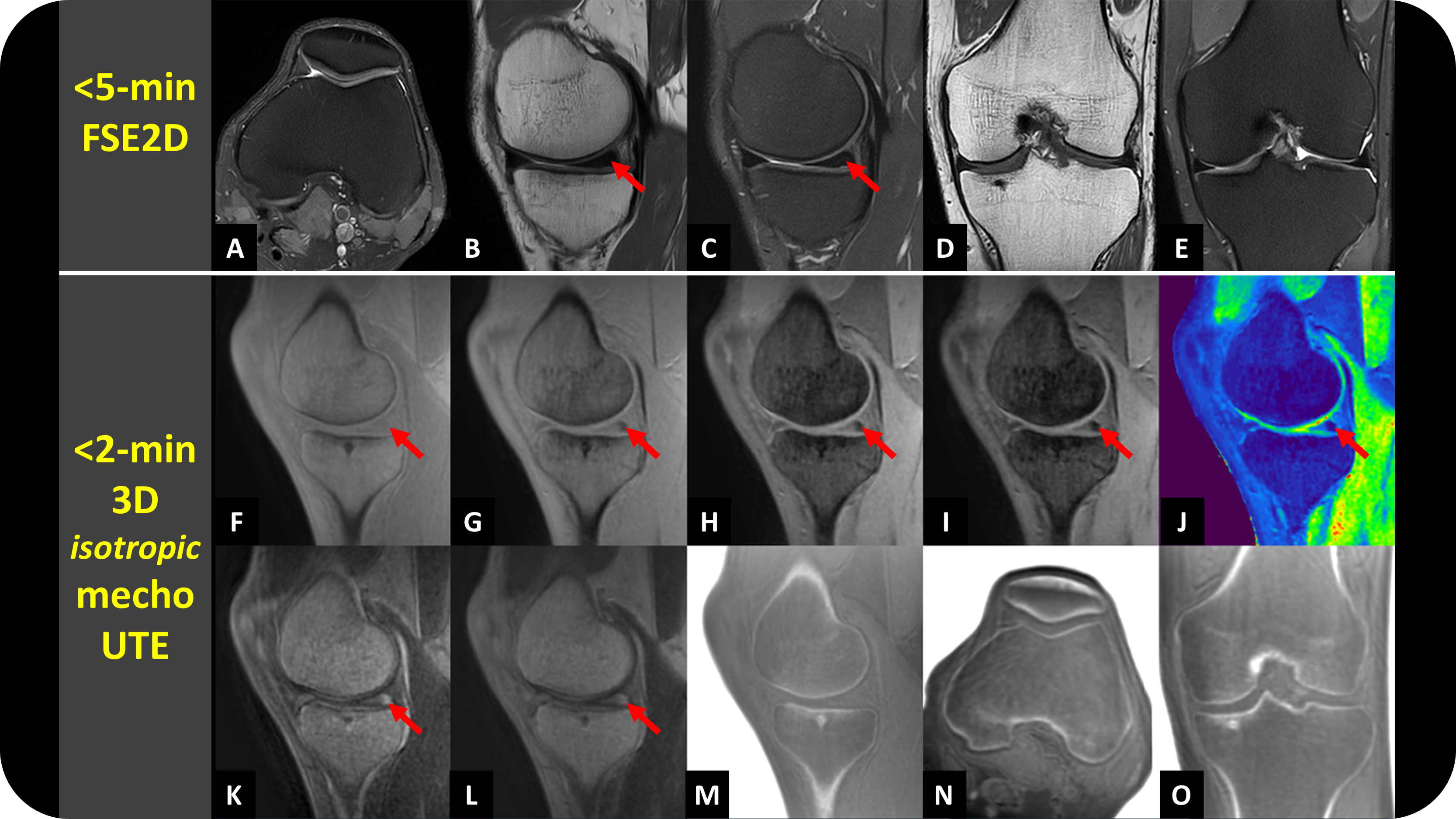 Comprehensive MRI-only MSK Exam
