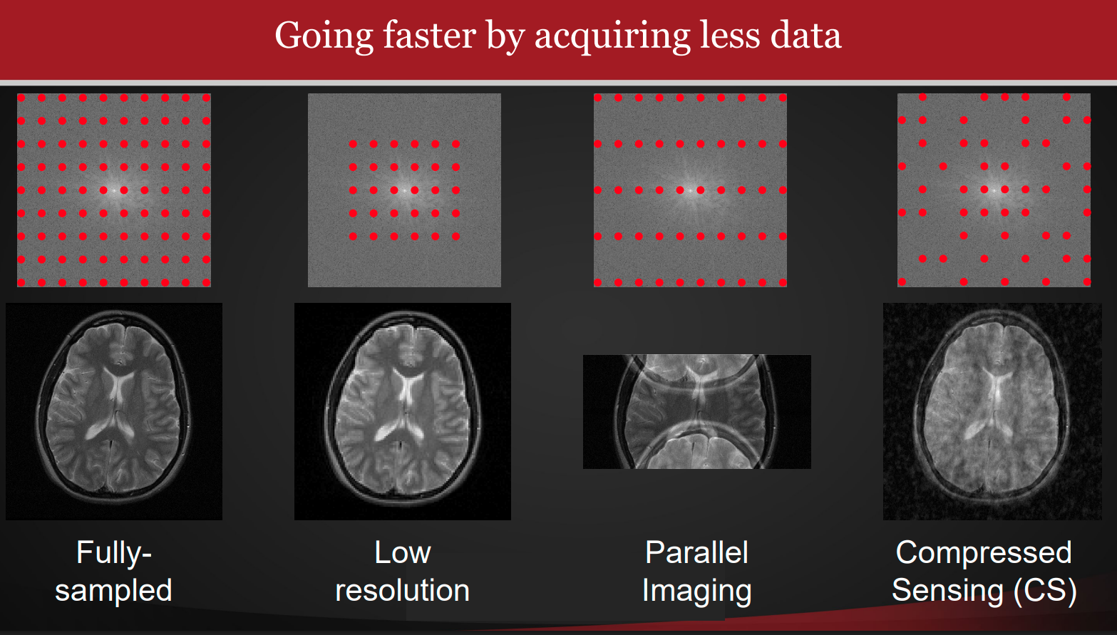 MRI Compressed Sensing Reconstruction