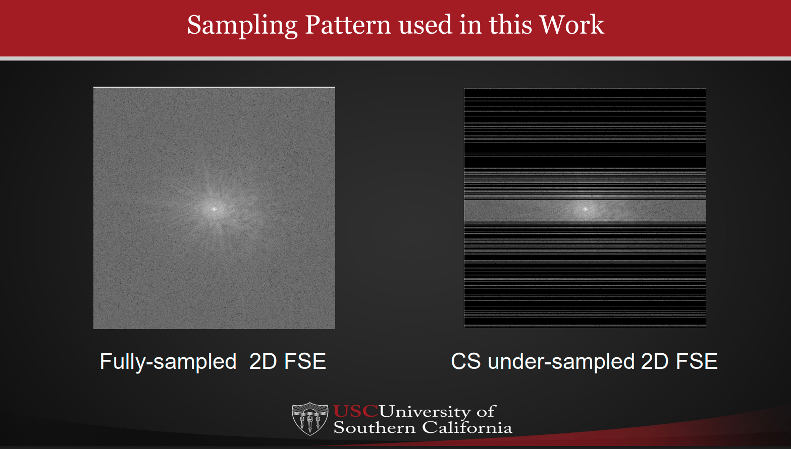 MRI Compressed Sensing Reconstruction
