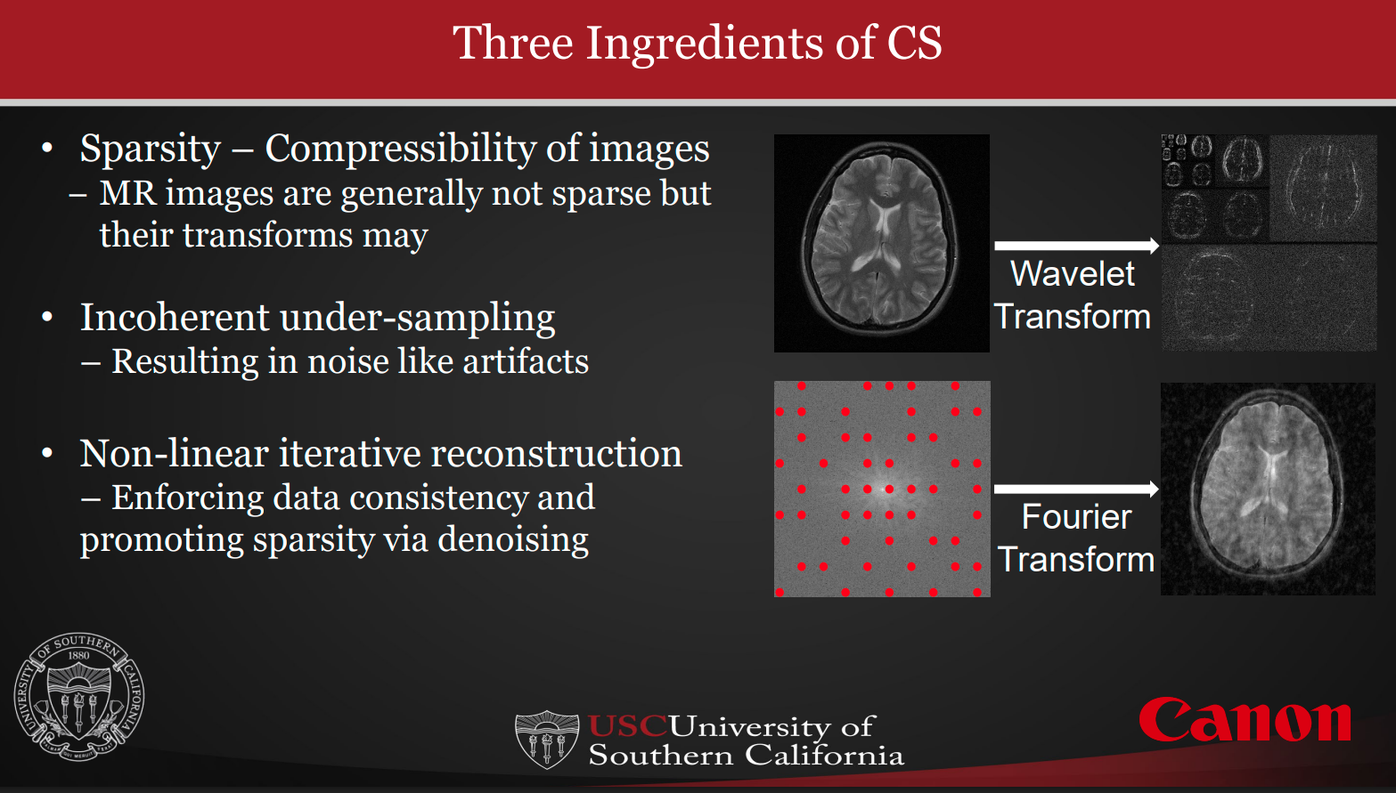 MRI Compressed Sensing Reconstruction