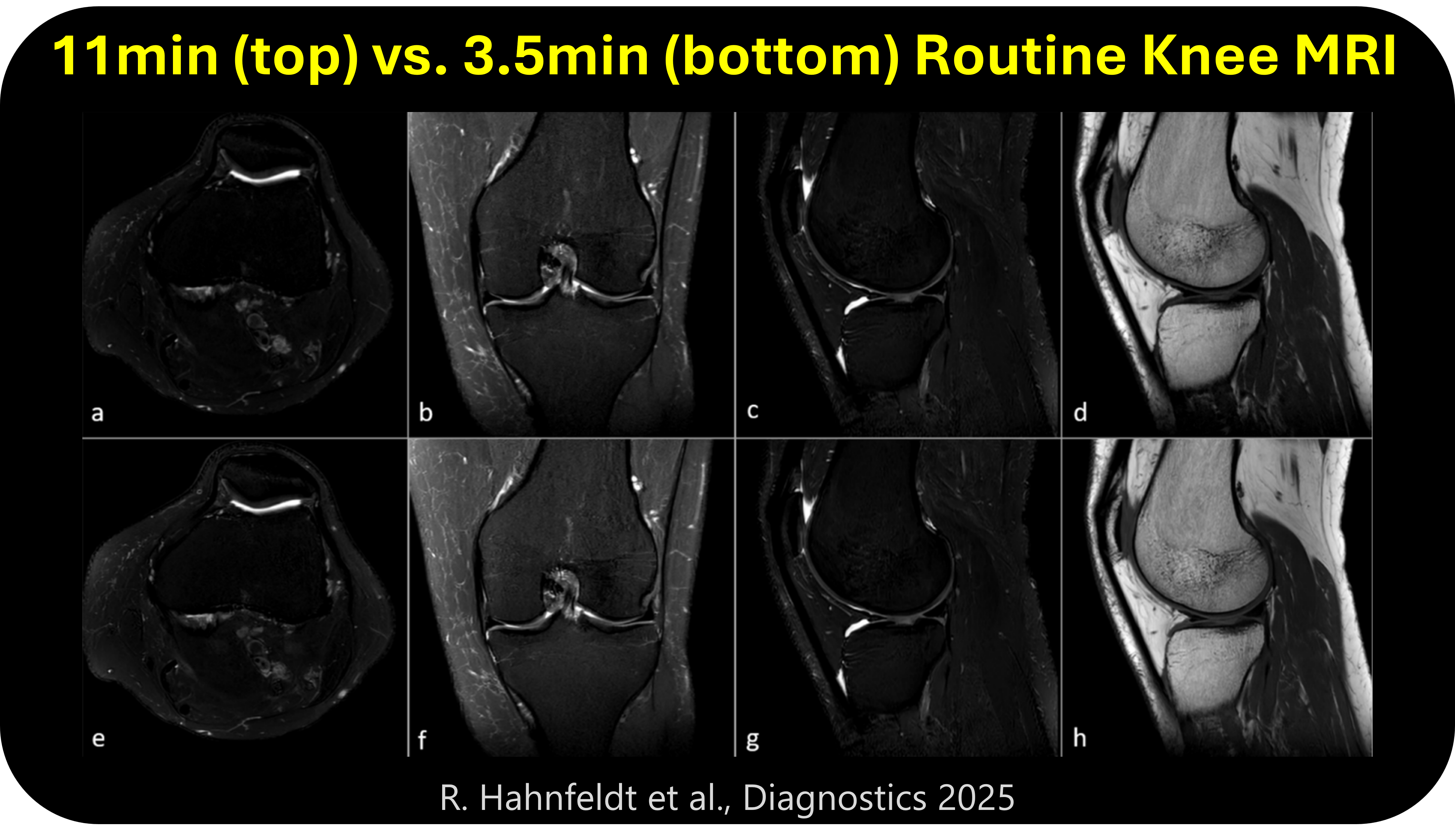 Comprehensive MRI-only MSK Exam